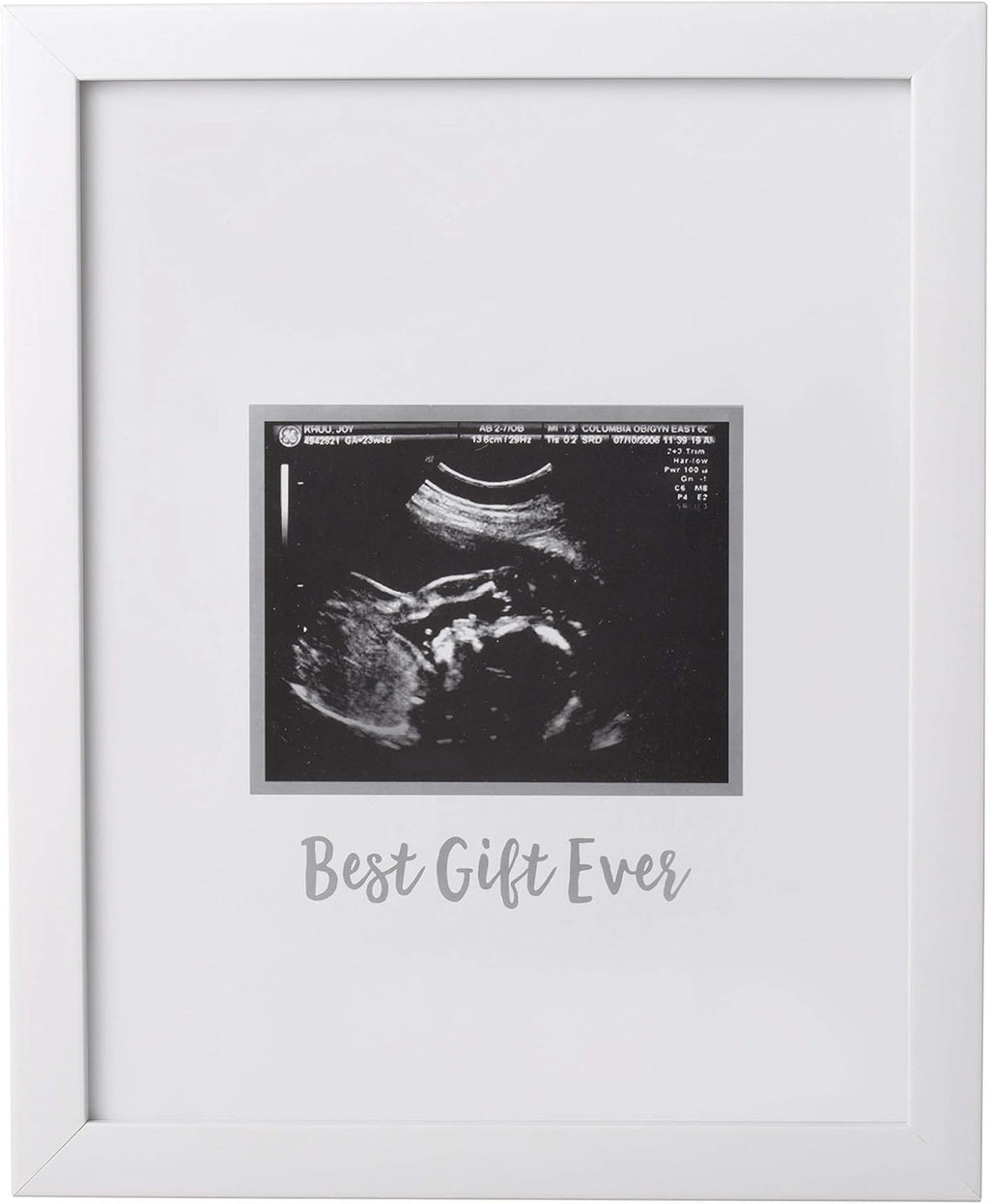 Guest Signature Sonogram Keepsake Frame