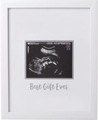 Guest Signature Sonogram Keepsake Frame