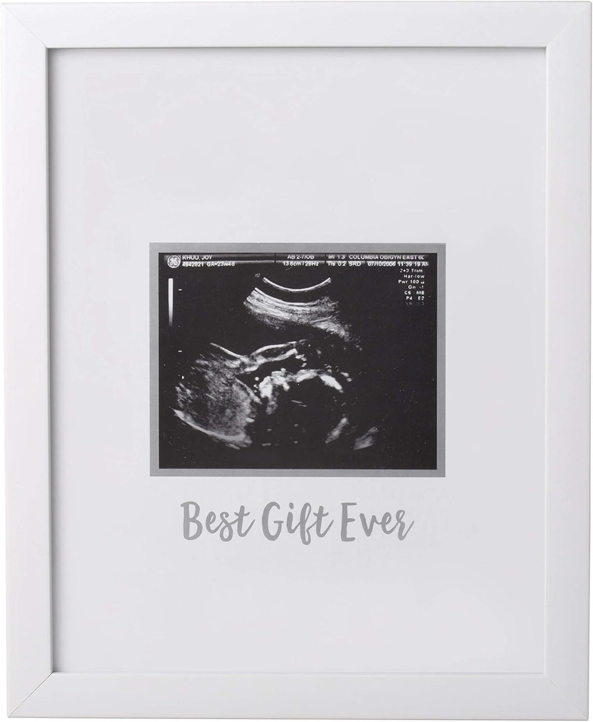 Guest Signature Sonogram Keepsake Frame